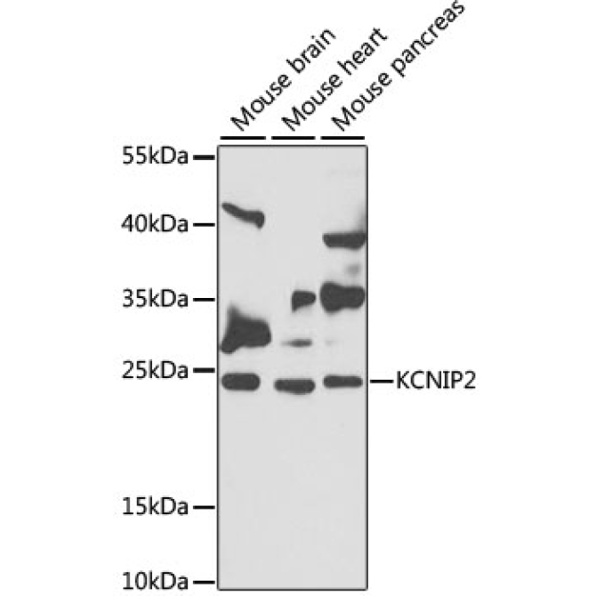 KCNIP2 Rabbit Polyclonal Antibody