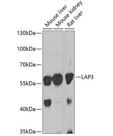 LAP3 Rabbit Polyclonal Antibody