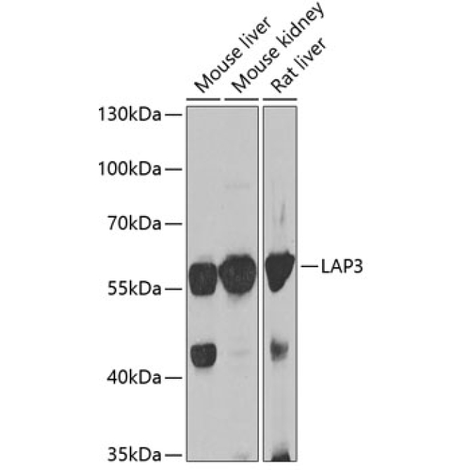 LAP3 Rabbit Polyclonal Antibody