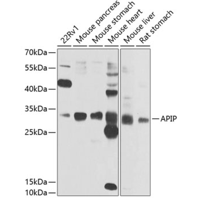 APIP Rabbit Polyclonal Antibody