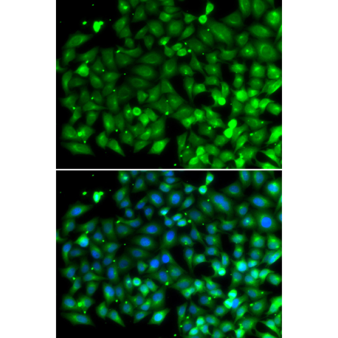 Bif-1 Rabbit Polyclonal Antibody