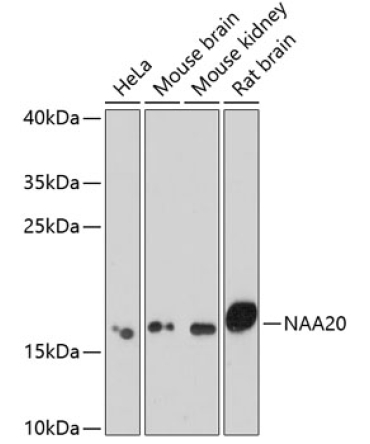 NAA20 Rabbit Polyclonal Antibody