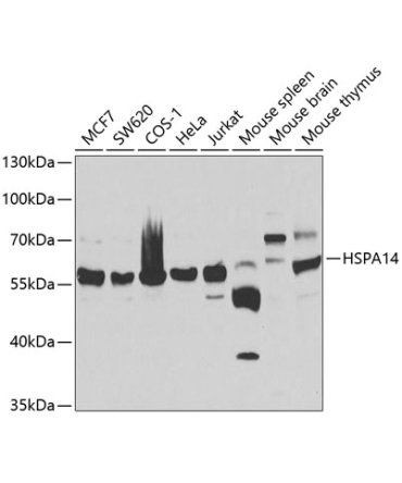 HSPA14 Rabbit Polyclonal Antibody