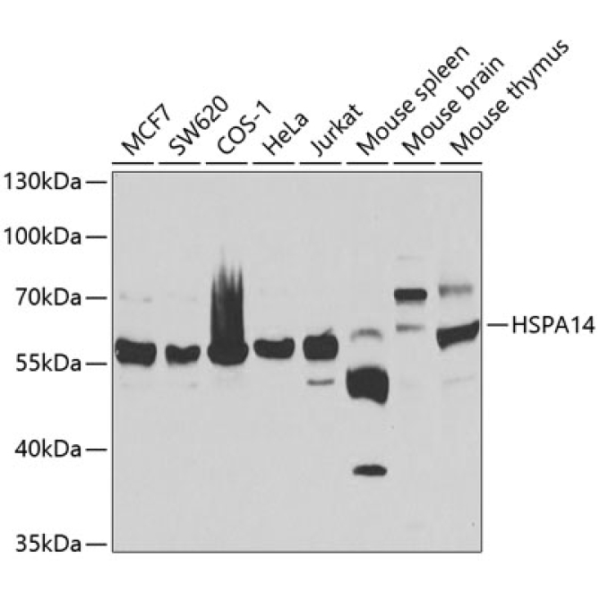 HSPA14 Rabbit Polyclonal Antibody