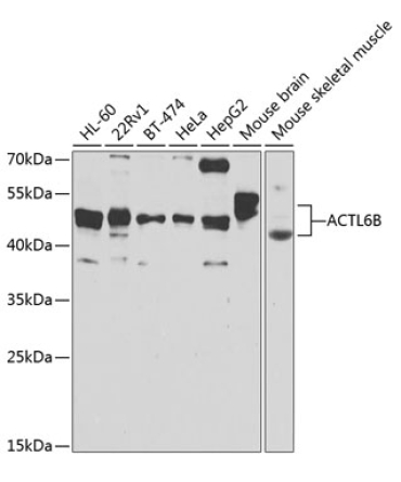 ACTL6B Rabbit Polyclonal Antibody