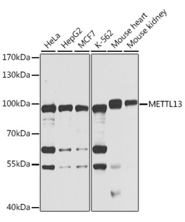 METTL13 Rabbit Polyclonal Antibody