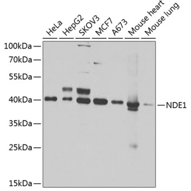NDE1 Rabbit Polyclonal Antibody