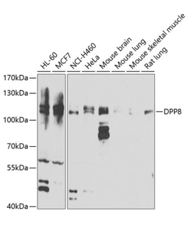DPP8 Rabbit Polyclonal Antibody