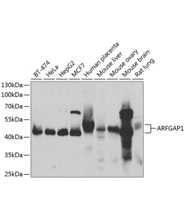 ARFGAP1 Rabbit Polyclonal Antibody