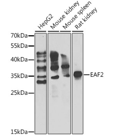 EAF2 Rabbit Polyclonal Antibody