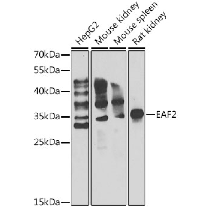 EAF2 Rabbit Polyclonal Antibody
