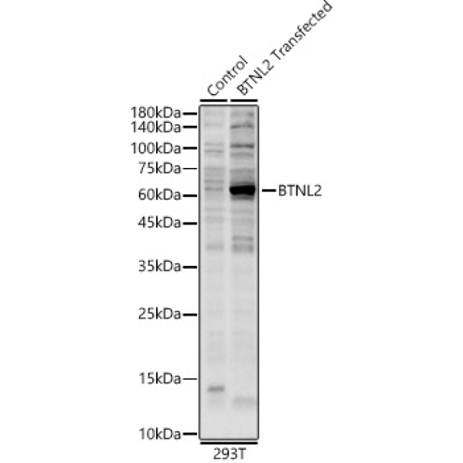 BTNL2 Rabbit Polyclonal Antibody