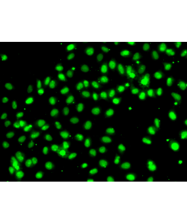 MEPCE Rabbit Polyclonal Antibody