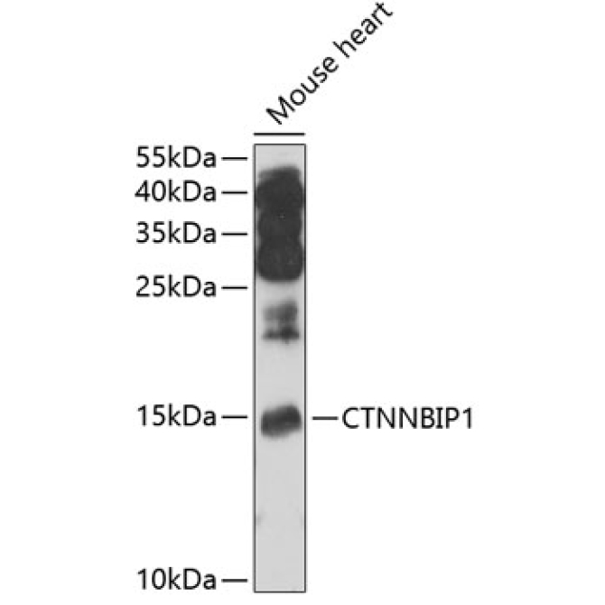 CTNNBIP1 Rabbit Polyclonal Antibody
