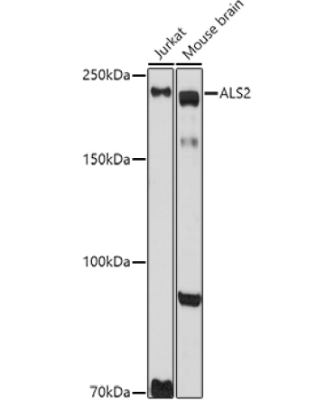 ALS2 Rabbit Polyclonal Antibody