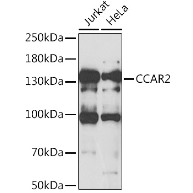 CCAR2 Rabbit Polyclonal Antibody