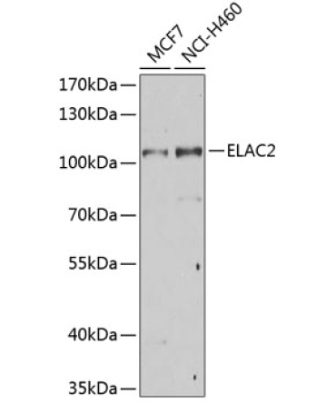 ELAC2 Rabbit Polyclonal Antibody
