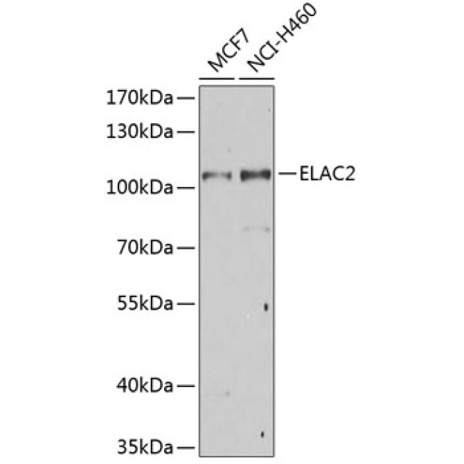 ELAC2 Rabbit Polyclonal Antibody