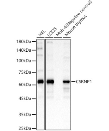 CSRNP1 Rabbit Polyclonal Antibody