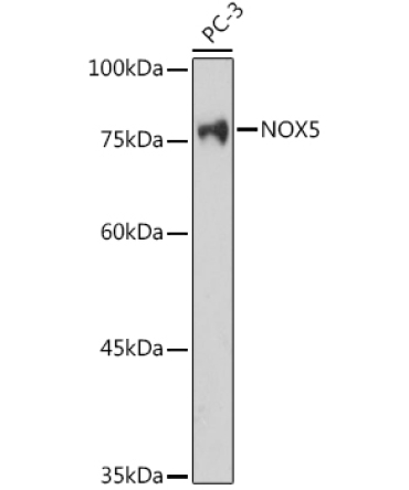 NOX5 Rabbit Polyclonal Antibody