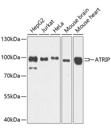 ATRIP Rabbit Polyclonal Antibody