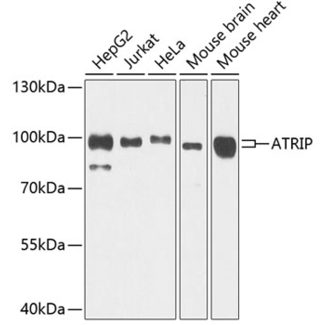 ATRIP Rabbit Polyclonal Antibody