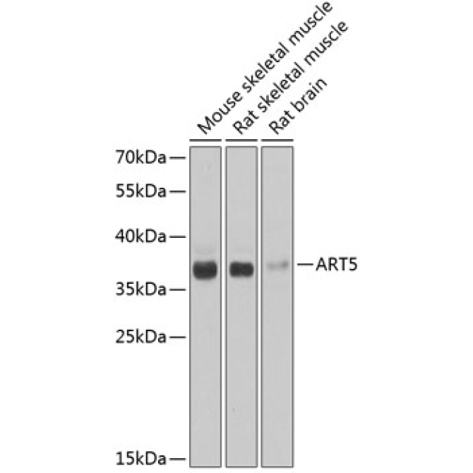 ART5 Rabbit Polyclonal Antibody
