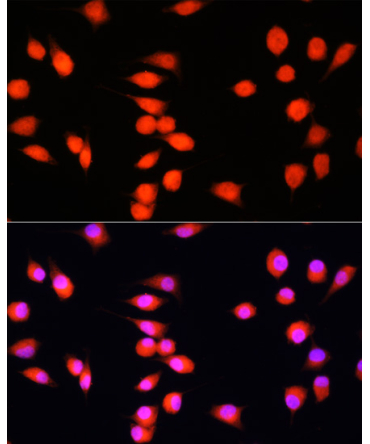 COMMD1 Rabbit Polyclonal Antibody