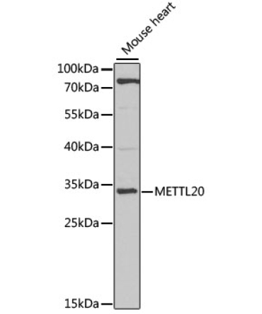 METTL20 Rabbit Polyclonal Antibody