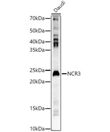 NCR3 Rabbit Polyclonal Antibody