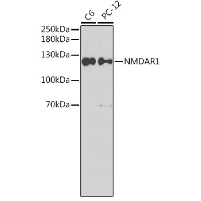 NMDAR1 Rabbit Polyclonal Antibody