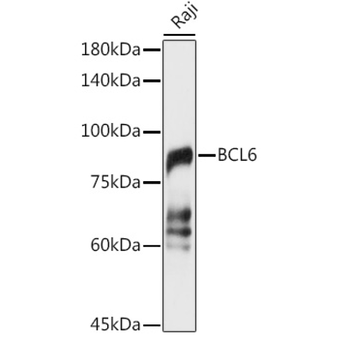 BCL6 Rabbit Polyclonal Antibody