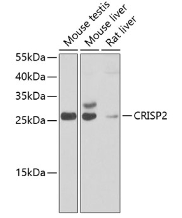 CRISP2 Rabbit Polyclonal Antibody