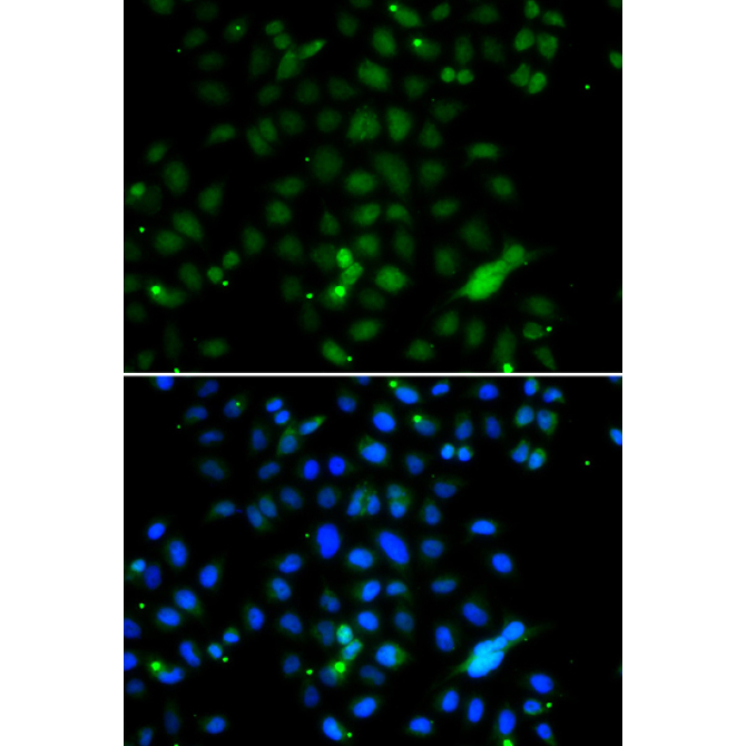 ELF4 Rabbit Polyclonal Antibody
