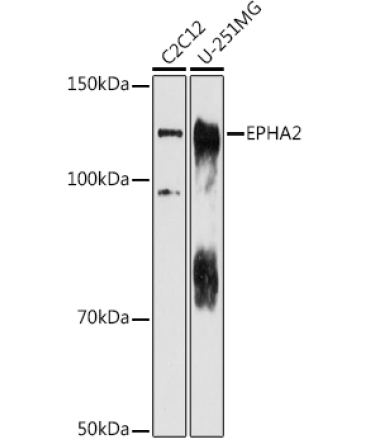 EPHA2 Rabbit Polyclonal Antibody
