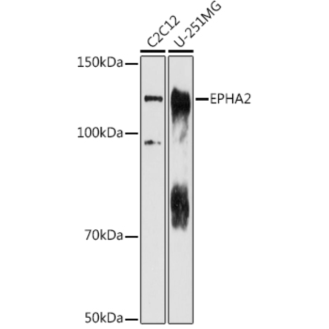 EPHA2 Rabbit Polyclonal Antibody