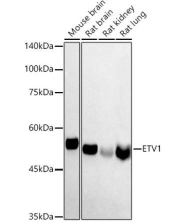 ETV1 Rabbit Polyclonal Antibody