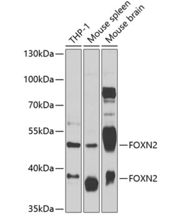 FOXN2 Rabbit Polyclonal Antibody