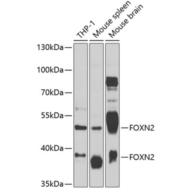 FOXN2 Rabbit Polyclonal Antibody