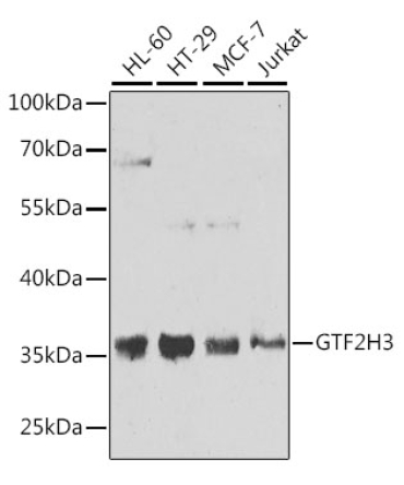 GTF2H3 Rabbit Polyclonal Antibody