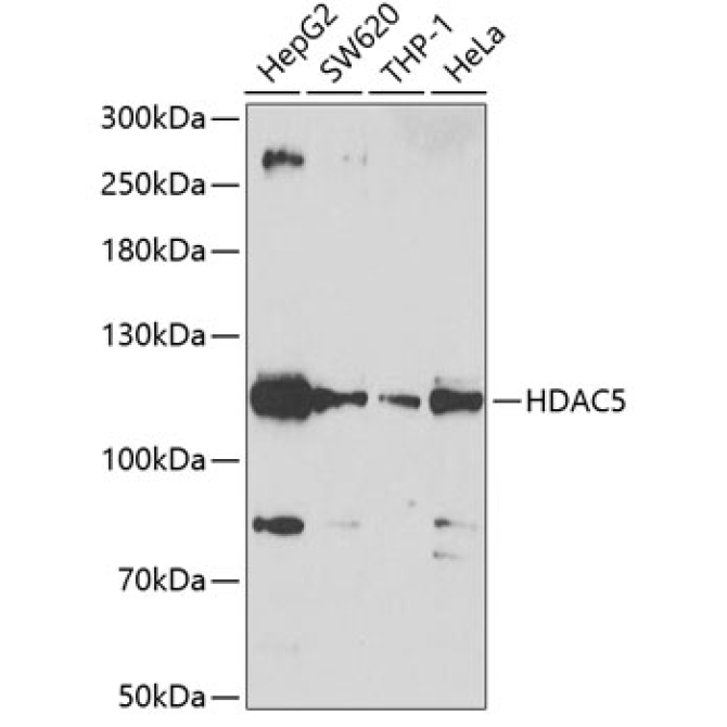 HDAC5 Rabbit Polyclonal Antibody