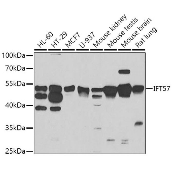 IFT57 Rabbit Polyclonal Antibody