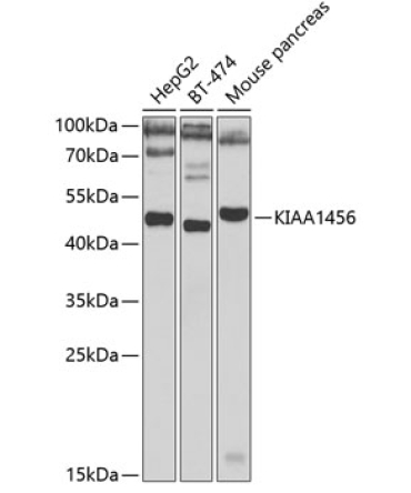 KIAA1456 Rabbit Polyclonal Antibody