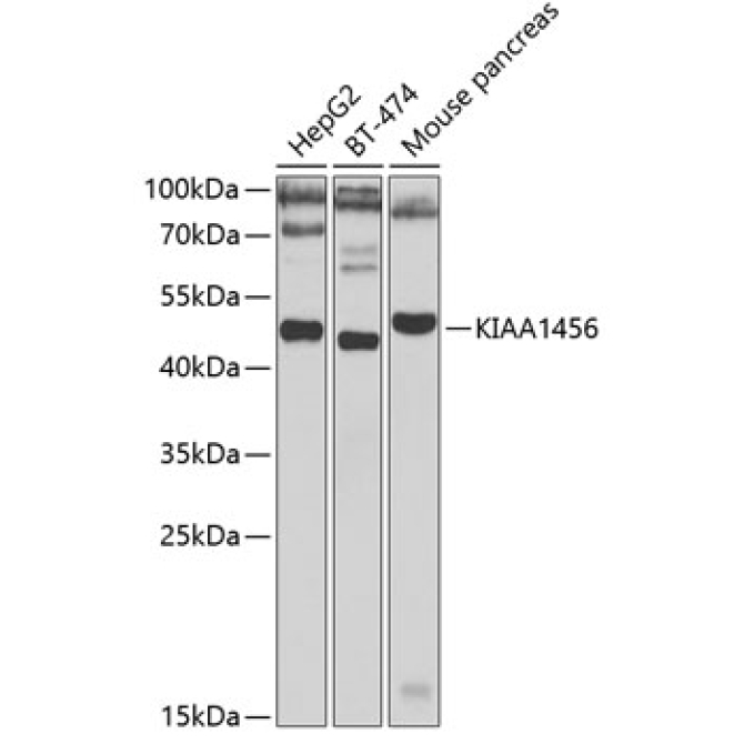 KIAA1456 Rabbit Polyclonal Antibody