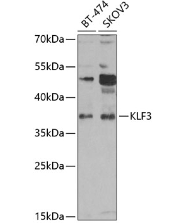 KLF3 Rabbit Polyclonal Antibody