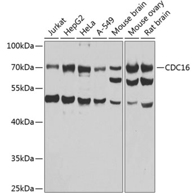 CDC16 Rabbit Polyclonal Antibody