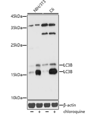 LC3B Rabbit Polyclonal Antibody [KD Validated]