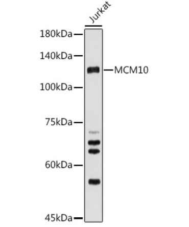 MCM10 Rabbit Polyclonal Antibody