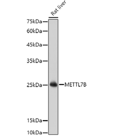 METTL7B Rabbit Polyclonal Antibody