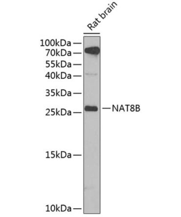 NAT8B Rabbit Polyclonal Antibody